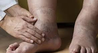 Böbrek sağlığı için önemli