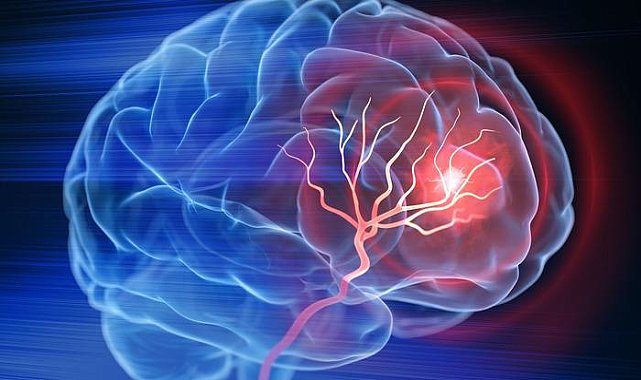 'Kritik öneme sahip' Sağlıklı beyin için 10 süper gıda! Alzheimer riskini azaltıyor, beyni zırh gibi güçlendiriyor